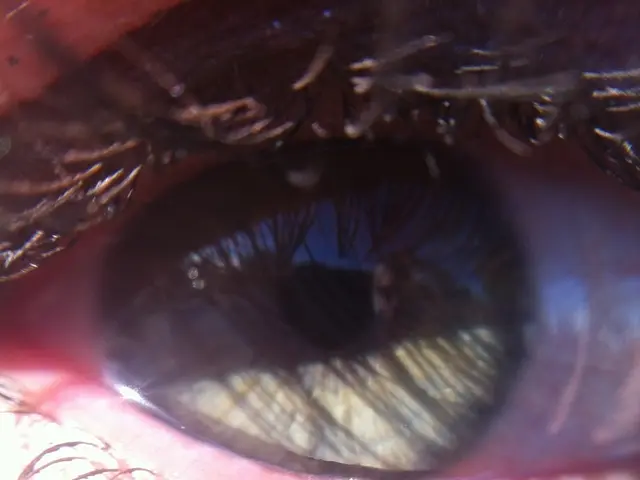 Tired of Sagging Eyelids? Explore 3 Surgical Alternatives Avoidance Options